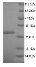 Recombinant Escherichia coli Oxygen-insensitive NADPH nitroreductase (nfsA) – Figure 1 of 1