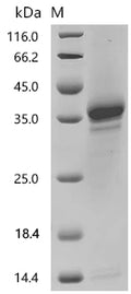 (Tris-Glycine gel) Discontinuous SDS-PAGE (reduced) with 5% enrichment gel and 15% separation gel.