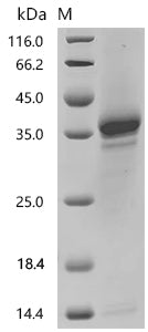 (Tris-Glycine gel) Discontinuous SDS-PAGE (reduced) with 5% enrichment gel and 15% separation gel.