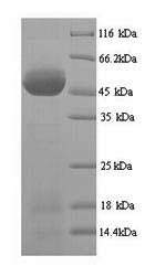 Recombinant African cassava mosaic virus Replication-associated protein (AC1) – Figure 1 of 1