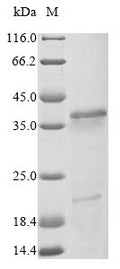 (Tris-Glycine gel) Discontinuous SDS-PAGE (reduced) with 5% enrichment gel and 15% separation gel.
