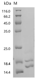 (Tris-Glycine gel) Discontinuous SDS-PAGE (reduced) with 5% enrichment gel and 15% separation gel.