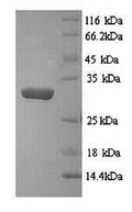 Recombinant Salmonella typhi 3-dehydroquinate dehydratase (aroD) – Figure 1 of 1