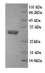 Recombinant Salmonella typhi 3-dehydroquinate dehydratase (aroD) – Figure 1 of 1
