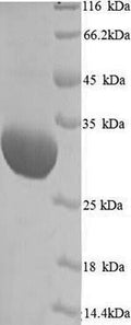 (Tris-Glycine gel) Discontinuous SDS-PAGE (reduced) with 5% enrichment gel and 15% separation gel.