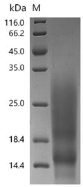 (Tris-Glycine gel) Discontinuous SDS-PAGE (reduced) with 5% enrichment gel and 15% separation gel.