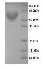 (Tris-Glycine gel) Discontinuous SDS-PAGE (reduced) with 5% enrichment gel and 15% separation gel.