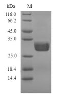 (Tris-Glycine gel) Discontinuous SDS-PAGE (reduced) with 5% enrichment gel and 15% separation gel.