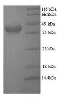 Recombinant Escherichia coli CFA/I fimbrial subunit E (cfaE) – Figure 1 of 1