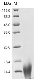 (Tris-Glycine gel) Discontinuous SDS-PAGE (reduced) with 5% enrichment gel and 15% separation gel.