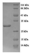 Recombinant Bacillus subtilis L-cystine-binding protein tcyA (tcyA) – Figure 1 of 1