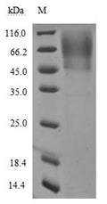 (Tris-Glycine gel) Discontinuous SDS-PAGE (reduced) with 5% enrichment gel and 15% separation gel. Predicted band size: 88.1 kDa
Observed band size: 116 kDa due to glycosylation