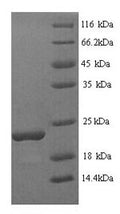 Recombinant Glycine max Stress-induced protein SAM22 (PR-10) – Figure 1 of 1