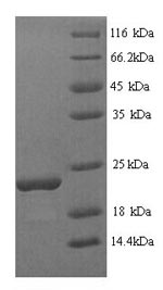 Recombinant Glycine max Stress-induced protein SAM22 (PR-10) – Figure 1 of 1