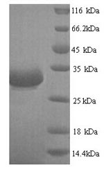 Recombinant Escherichia coli Beta-lactamase CTX-M-1 (bla) – Figure 1 of 1