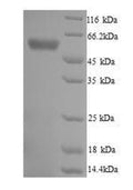 Recombinant Trypanosoma cruzi Trypanothione reductase (TPR) – Figure 1 of 1