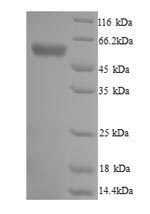 Recombinant Trypanosoma cruzi Trypanothione reductase (TPR) – Figure 1 of 1
