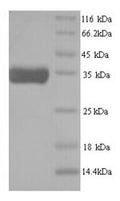 Recombinant Caenorhabditis elegans ATP-dependent (S)-NAD(P)H-hydRate dehydRatase(R107.2) – Figure 1 of 1