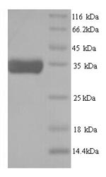 Recombinant Caenorhabditis elegans ATP-dependent (S)-NAD(P)H-hydRate dehydRatase(R107.2) – Figure 1 of 1