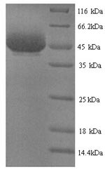 Recombinant Vibrio cholerae serotype O1 Zona occludens toxin (zot) – Figure 1 of 1