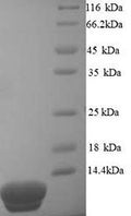 Recombinant Sulfolobus solfataricus DNA-binding protein 7d (sso7d) – Figure 1 of 1