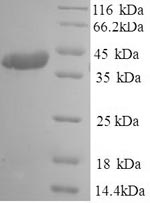 Recombinant Human coronavirus OC43 Spike glycoprotein (S), partial – Figure 1 of 1