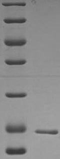 (Tris-Glycine gel) Discontinuous SDS-PAGE (reduced) with 5% enrichment gel and 15% separation gel.