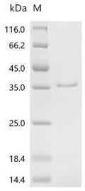 (Tris-Glycine gel) Discontinuous SDS-PAGE (reduced) with 5% enrichment gel and 15% separation gel.