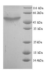 Recombinant Escherichia coli Cytosine deaminase (codA) – Figure 1 of 1