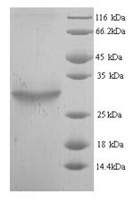 Recombinant Escherichia coli 1-acyl-sn-glycerol-3-phosphate acyltransferase (plsC) – Figure 1 of 1