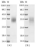 (Tris-Glycine gel) Discontinuous SDS-PAGE (reduced) with 5% enrichment gel and 15% separation gel.