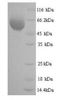 Recombinant Eschscholzia californica Reticuline oxidase (BBE1) – Figure 1 of 1