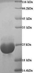 Recombinant Onchocerca volvulus OV-16 antigen (OV16) – Figure 1 of 1