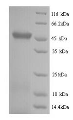 Recombinant Escherichia coli RNA-splicing ligase RtcB (rtcB) – Figure 1 of 1