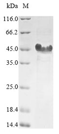 (Tris-Glycine gel) Discontinuous SDS-PAGE (reduced) with 5% enrichment gel and 15% separation gel.