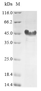 (Tris-Glycine gel) Discontinuous SDS-PAGE (reduced) with 5% enrichment gel and 15% separation gel.