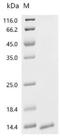 (Tris-Glycine gel) Discontinuous SDS-PAGE (reduced) with 5% enrichment gel and 15% separation gel.