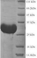 Recombinant Rat Thyroxine 5-deiodinase (Dio3), partial (170:U→missing) – Figure 1 of 1