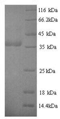 Recombinant Helicobacter pylori Cytotoxicity-associated immunodominant antigen (cagA), partial – Figure 1 of 1