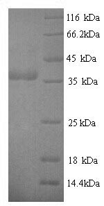 Recombinant Helicobacter pylori Cytotoxicity-associated immunodominant antigen (cagA), partial – Figure 1 of 1