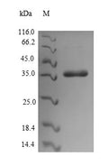Recombinant Escherichia coli CS6 fimbrial subunit B (cssB) – Figure 1 of 1