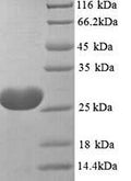 Recombinant Toxocara canis 26KDA secreted antigen (TES-26) – Figure 1 of 1