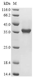 (Tris-Glycine gel) Discontinuous SDS-PAGE (reduced) with 5% enrichment gel and 15% separation gel.