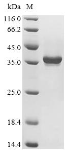 (Tris-Glycine gel) Discontinuous SDS-PAGE (reduced) with 5% enrichment gel and 15% separation gel.