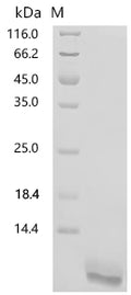 (Tris-Glycine gel) Discontinuous SDS-PAGE (reduced) with 5% enrichment gel and 15% separation gel.