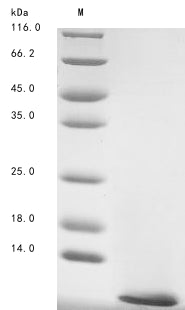 (Tris-Glycine gel) Discontinuous SDS-PAGE (reduced) with 5% enrichment gel and 15% separation gel.