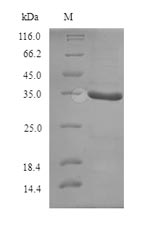 (Tris-Glycine gel) Discontinuous SDS-PAGE (reduced) with 5% enrichment gel and 15% separation gel.