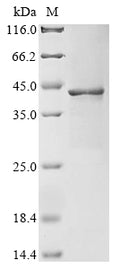 (Tris-Glycine gel) Discontinuous SDS-PAGE (reduced) with 5% enrichment gel and 15% separation gel.