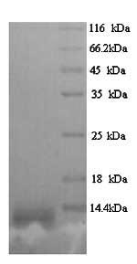 Recombinant Zaire ebolavirus Pre-small/secreted glycoprotein (GP) – Figure 1 of 1