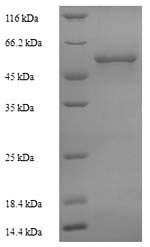 Recombinant Mycobacterium tuberculosis Steroid C26-monooxygenase (cyp125) – Figure 1 of 1